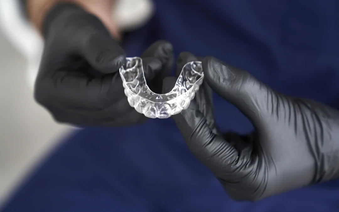 Il bite dentale: cos’è, come si costruisce e in quali situazioni è indicato